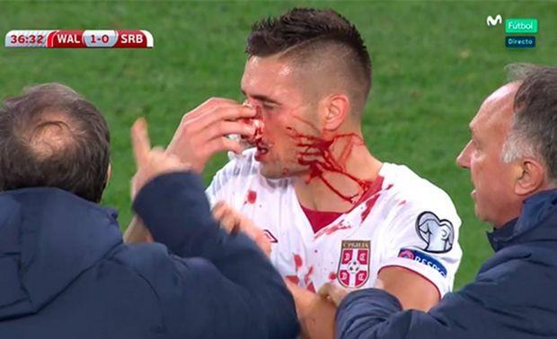 O Ντούσαν Τάντιτς, κατά τη διάρκεια του πρώτου ημιχρόνου στην αναμέτρηση της Ουαλίας με τη Σερβία, δέχθηκε μία κλωτσιά στο πρόσωπο, με αποτέλεσμα να γεμίσει με αίματα