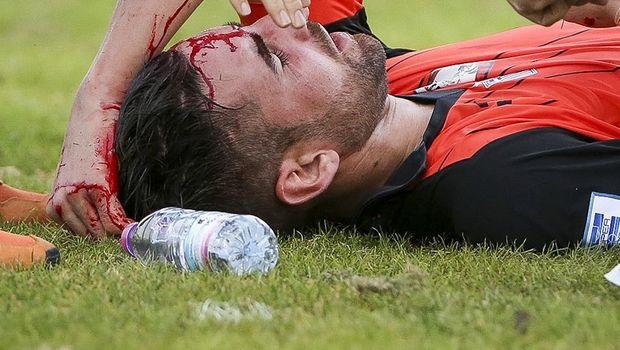 Ο Ματίας Κάστρο διεκομίσθη στο νοσοκομείο μετά τον τραυματισμό του στο κεφάλι, ύστερα από την εναέρια σύγκρουση με τον Τουράμ, στο Κέρκυρα - Ξάνθη