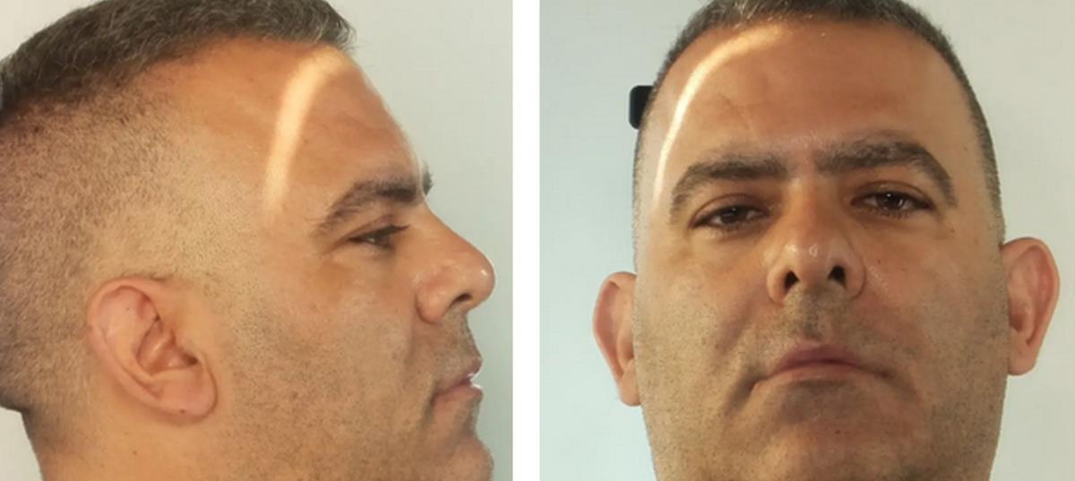 5242195697810236 image