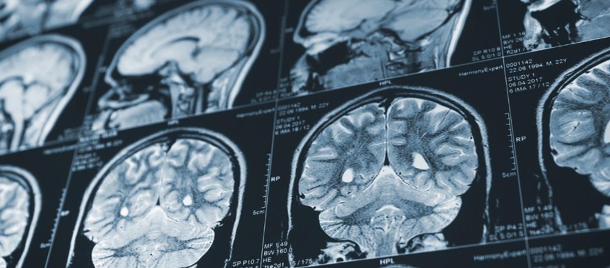 5244962041090896 cats