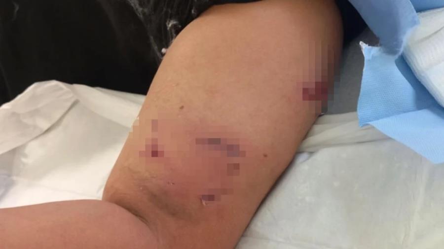 5331392092016830 maketa-epithesi-skulou