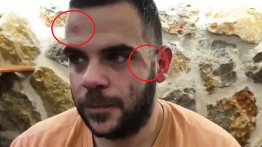 5339378069231277 teosty