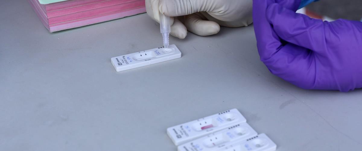 ΤΕΣΤ ΚΟΡΩΝΟΪΟΥ - COVID-19 - RAPID TEST